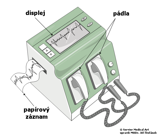 Defibrilator - schema