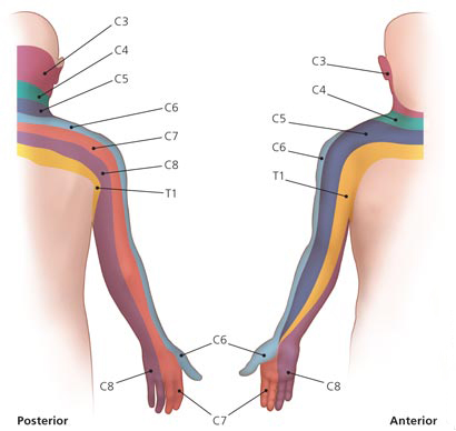 Dermatomy na horni koncetine