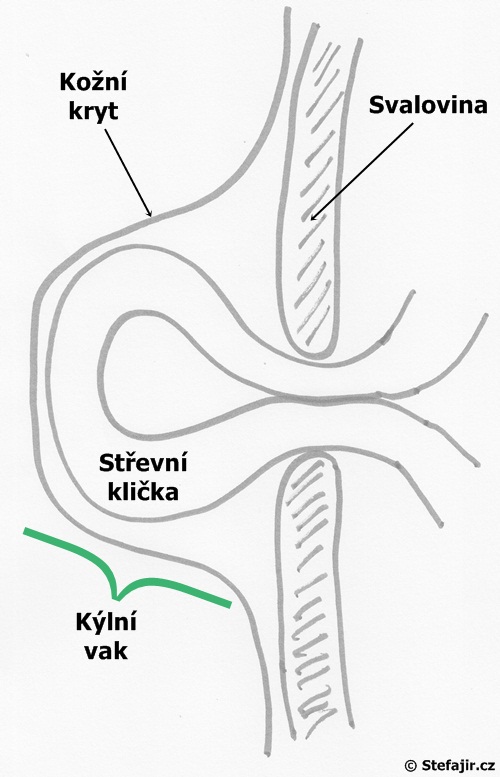 Brisni kyla
