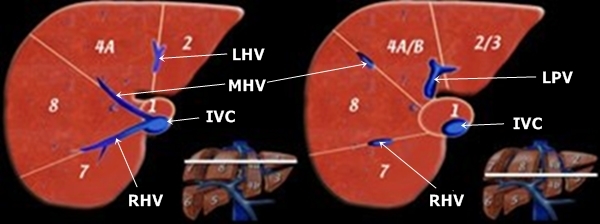 Liver segments - sonography