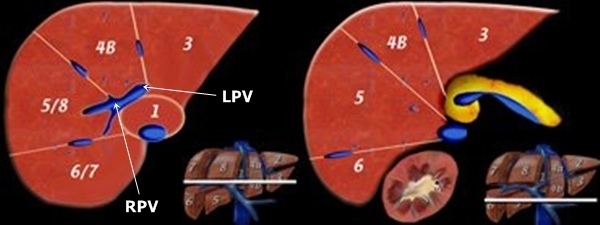 Liver segments - sonography