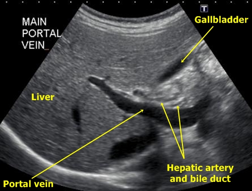 Liver hilum - sonography
