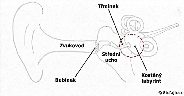 Otoskleroza - schema