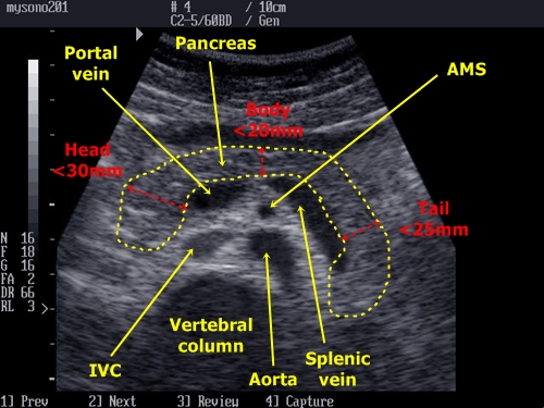 Pancreas - sonography