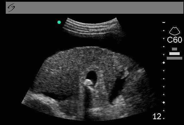 Sonography  Test 1