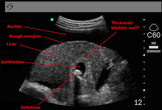 Sonography Answer 1