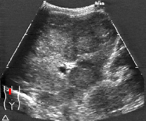 Sonography  Test 2