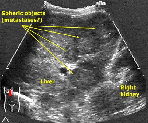 Sonography  Answer 2