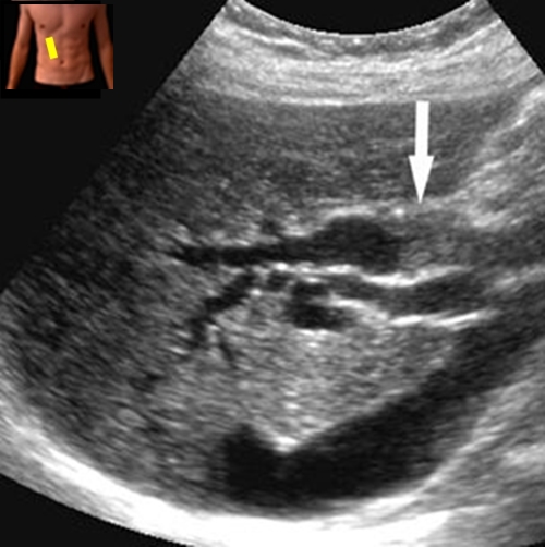 Sonography  Test 3