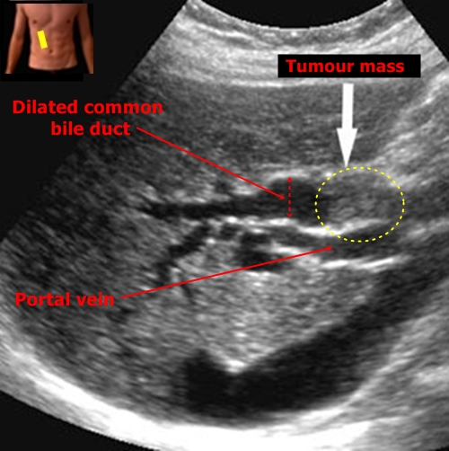 Sonography  Answer 3