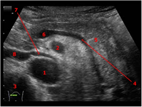 Sonography  Test 4