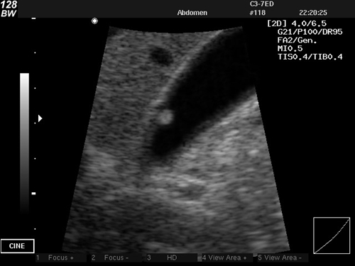 Sonography  Test 5