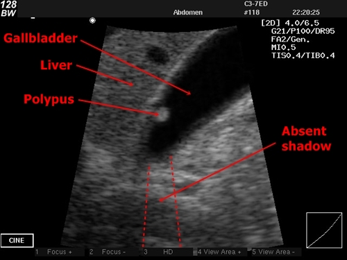 Sonography  Answer 5